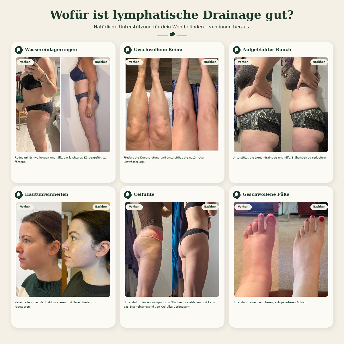 Lymera® Lymphatische Drainage